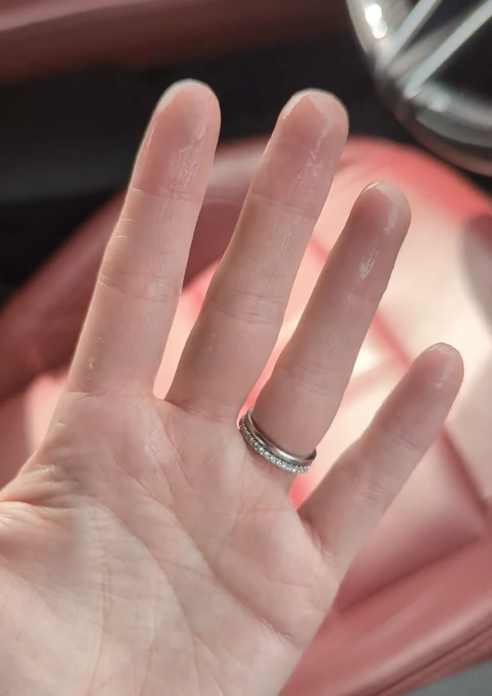 My hands sweating before using Dermadry